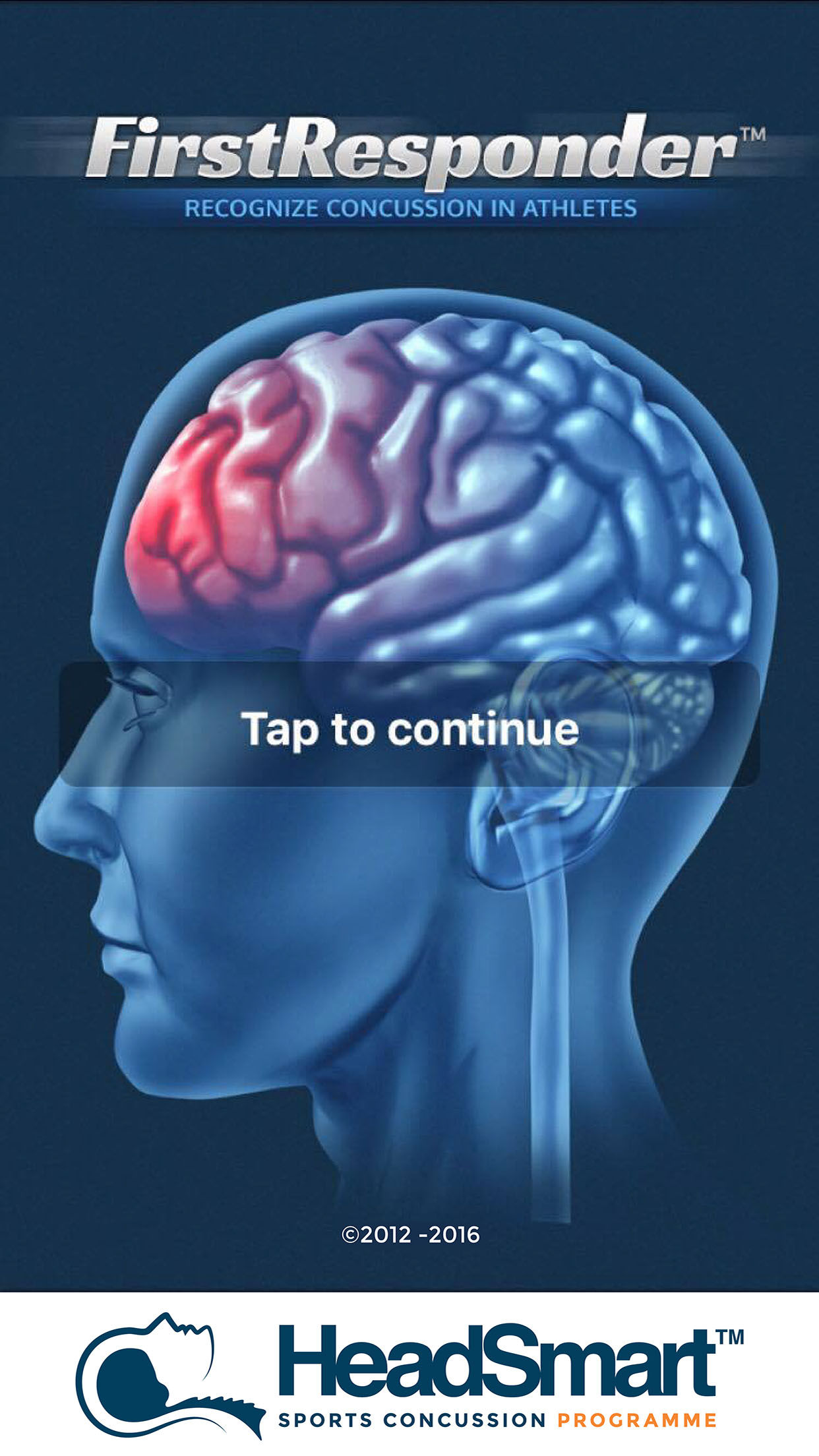 concussion app